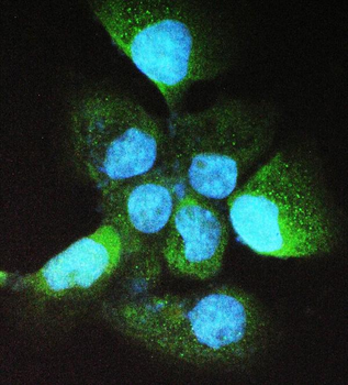 Anti-Alcohol dehydrogenase class-3 ADH5 Antibody
