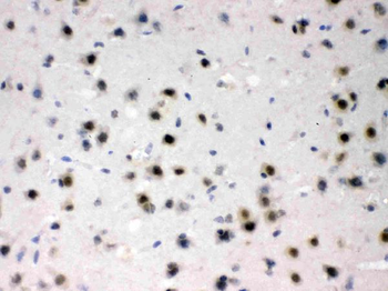 Anti-L-Arginine decarboxylase/AZIN2 Antibody