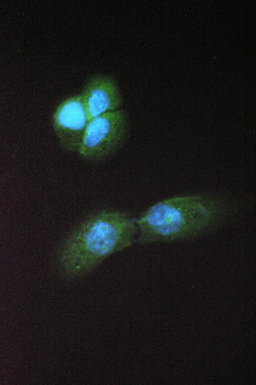 Anti-Abhd5 Antibody