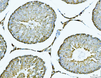 Anti-ATP citrate lyase/ACLY Antibody