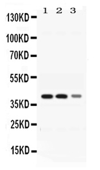 Anti-ADH4 Antibody