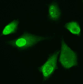 Anti-ADK Antibody