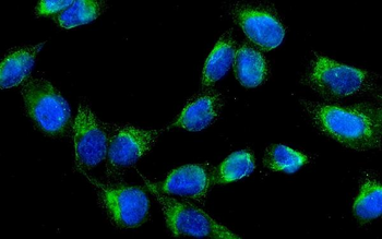 Anti-AK2 Antibody