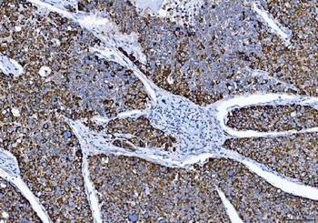 Anti-ALDH1B1 Antibody