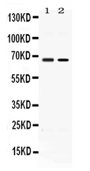 Anti-ACCN1/ASIC2 Antibody