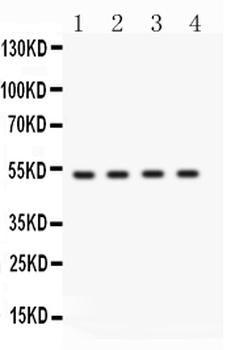 Anti-BDKRB2 Antibody