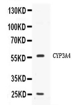 Cytochrome P450 3A4/CYP3A4 Antibody