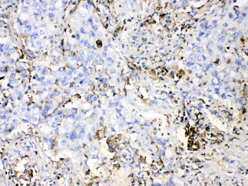 Anti-DHODH Antibody