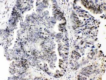 Anti-E2F4 Antibody