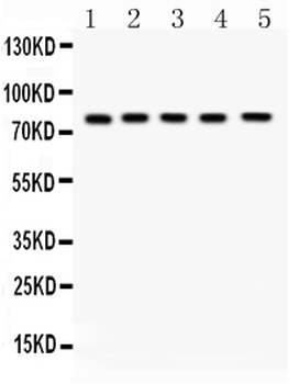 Anti-FSH Receptor/FSHR Antibody