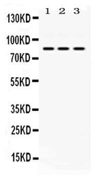 Anti-KRIT1 Antibody