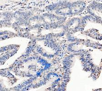 Anti-LDHA Antibody