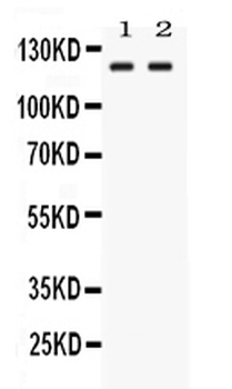 Anti-LRIG3 Antibody