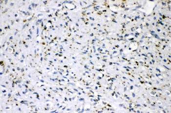 Anti-ADFP/PLIN2 Antibody