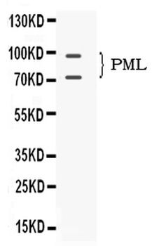 PML Protein Antibody