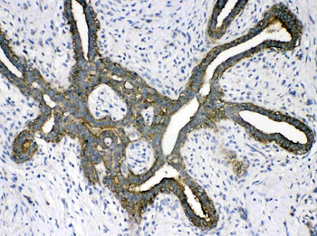 Anti-Phosphoserine Aminotransferase/PSAT1 Antibody