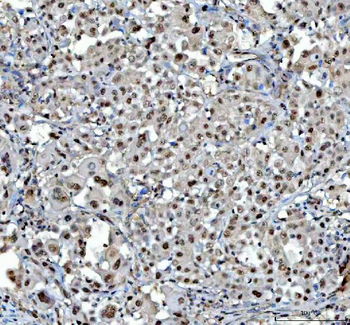 Anti-Proteasome 20S C2/PSMA1 Antibody