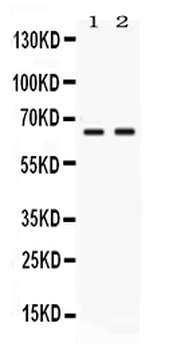 Anti-PVRL4/NECTIN4 Antibody