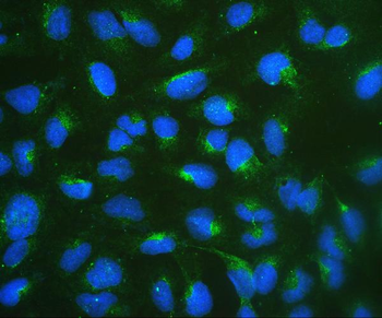 Anti-67kDa Laminin Receptor/RPSA Antibody