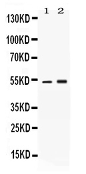 Anti-alpha 1 Antitrypsin/SERPINA1 Antibody