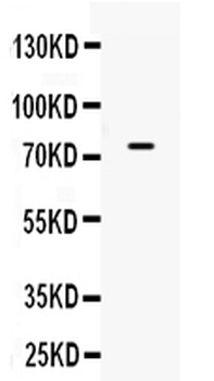Anti-ACSL3 Antibody