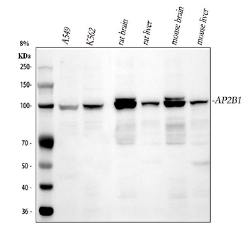 Anti-AP2B1 Antibody