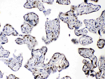 Anti-Diazepam Binding Inhibitor/DBI Antibody
