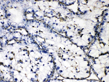 Anti-GAA Antibody