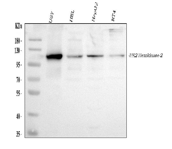 Anti-Hexokinase II/HK2 Antibody
