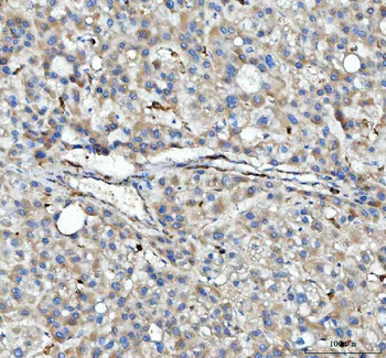 Anti-HLA-DPB1 Antibody