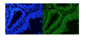 Anti-HnRNP A1/HNRNPA1 Antibody