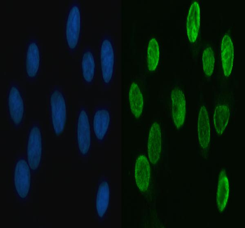 Anti-HnRNP L/HNRNPL Antibody