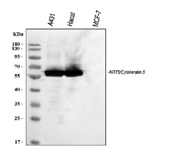 Cytokeratin 5/KRT5 Antibody