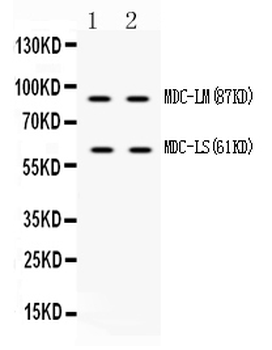 Anti-ADAM28 Antibody