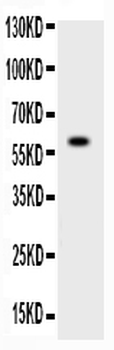 Anti-ADAMTS4/ADAMTS4 Antibody
