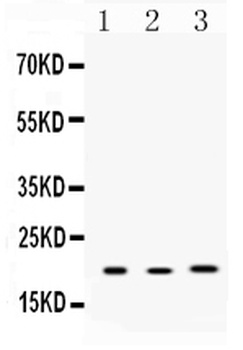 Anterior Gradient 2/AGR2 Antibody