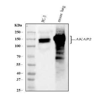 Anti-AKAP2 Antibody