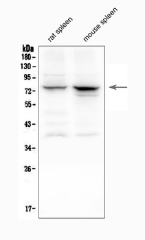 12 Lipoxygenase/ALOX12 Antibody