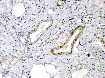 Anti-Angiopoietin-2/ANGPT2 Antibody
