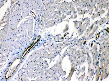 Anti-ANGPTL2 Antibody