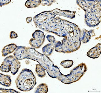Anti-Angiopoietin-like 4/ANGPTL4 Antibody
