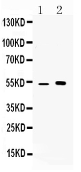 Anti-CDR2 Antibody