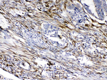 Anti-Cytoglobin/CYGB Antibody