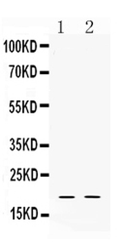 Anti-Alpha Defensin 1/DEFA1 Antibody