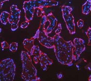 Anti-Cytokeratin 18/KRT18 Antibody