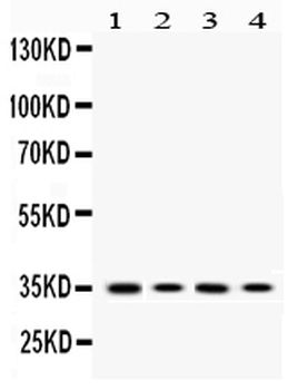 Anti-MC1 Receptor/MC1R Antibody