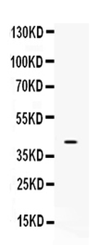 Anti-MC2 receptor/MC2R Antibody