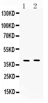 Anti-MC3 Receptor/MC3R Antibody