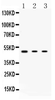Protein Kinase A regulatory subunit I alpha/PRKAR1A Antibody