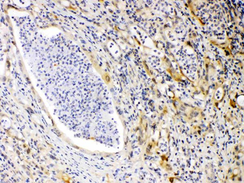 Anti-Protein Kinase A regulatory subunit I alpha/PRKAR1A Antibody